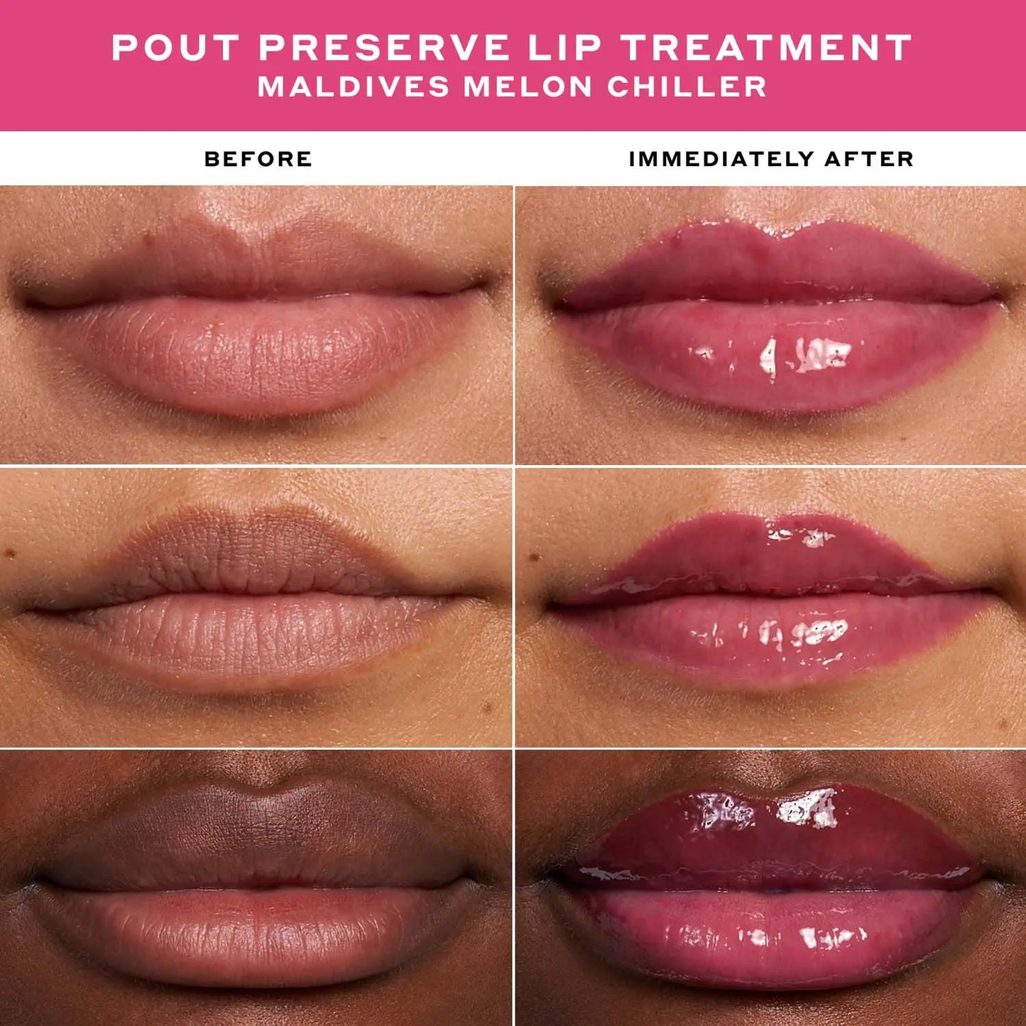 Pout Preserve Peptide Lip Treatment Chillers